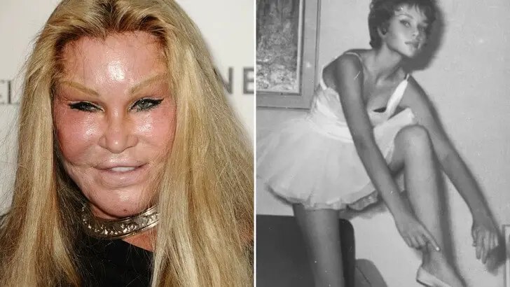 20 Intriguing Plastic Surgery Facts That Redefine Beauty